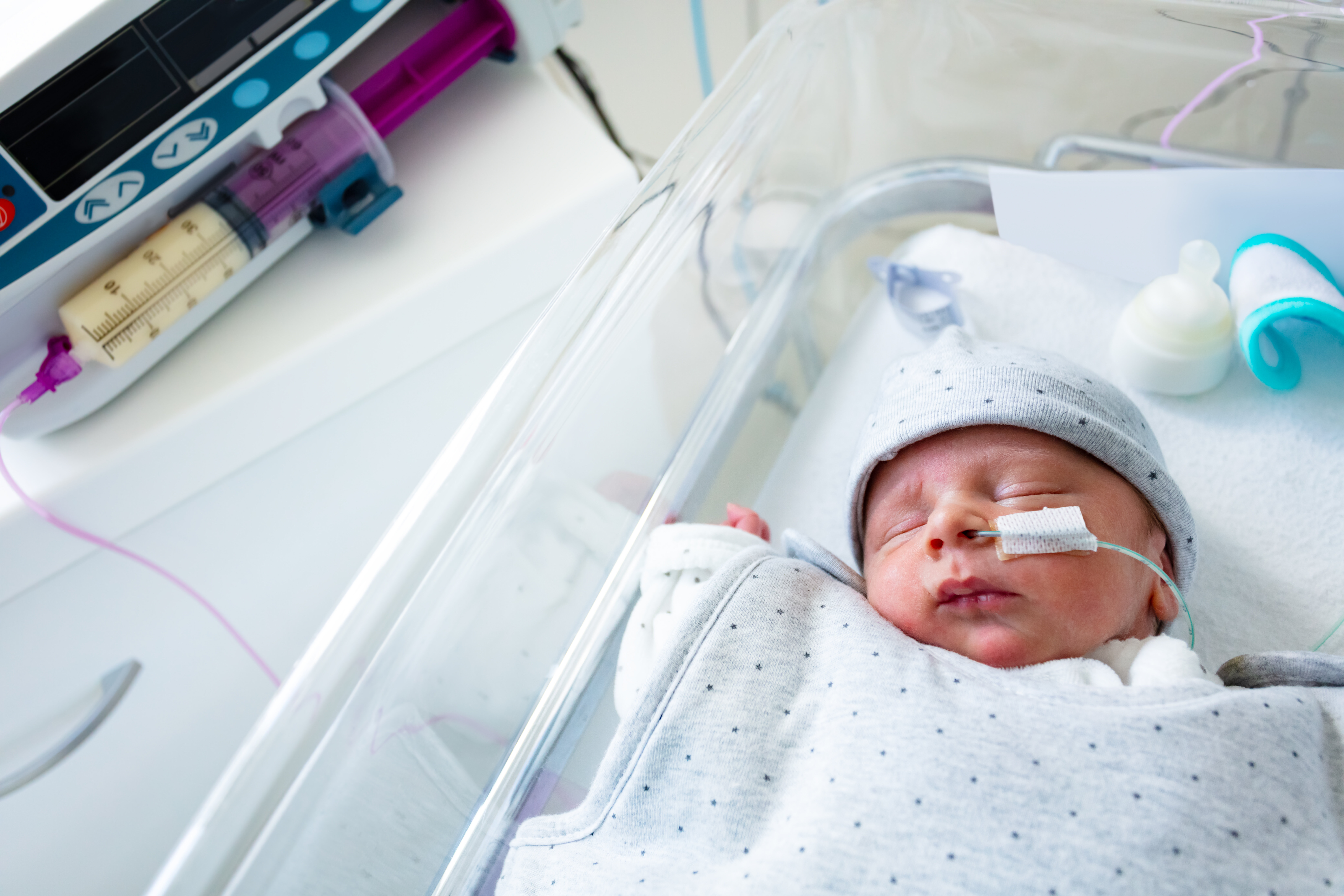 Bildet viser en baby i en sykehusseng. Den har sonde i nesten, og en sprøyte med morsmelk ligger ved siden av
