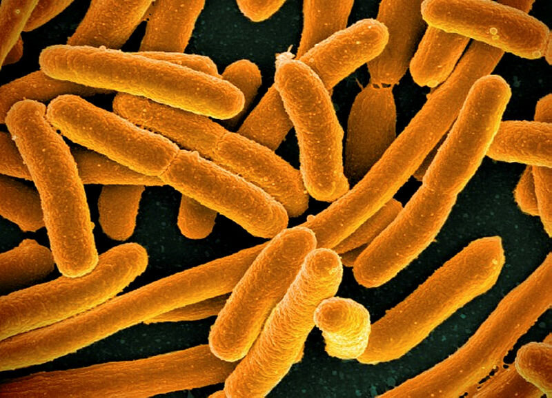 Bildet viser E. coli-bakterier
