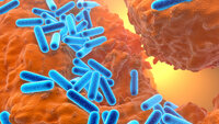 Pseudomonas aeruginosa